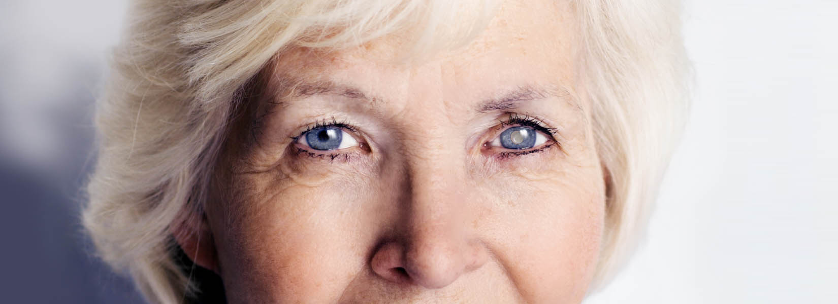 Cataract Surgery in Henderson